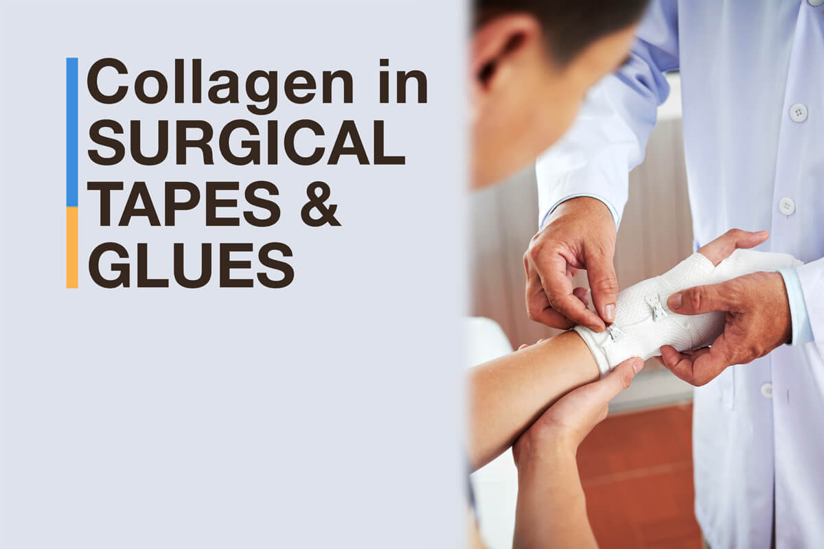 collagen in surgical glue
