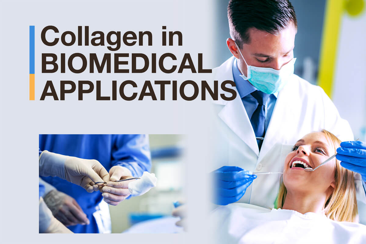collagen in biomedical applications