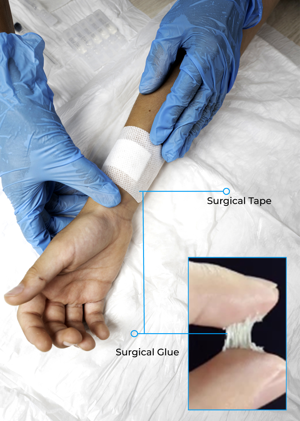 500-x-700-new-Collagen-wound-Glue-tape 500-x-700-new-Collagen-wound-Glue-tape